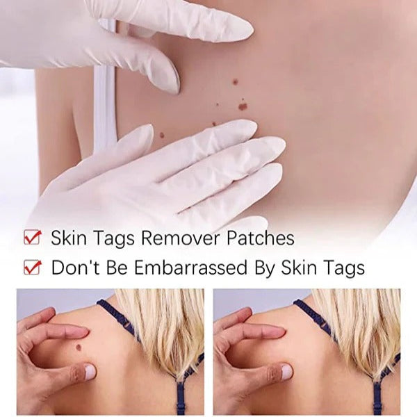 Skin Tag and Mole Appearance Cosmetic Oil